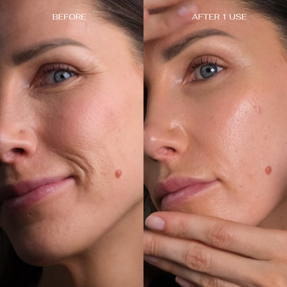 Intensely Moisturizing Face and Neck Care Set
